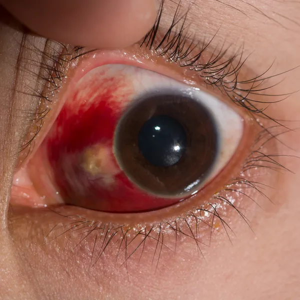 Eye exam — Stock Photo, Image