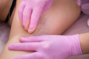 Şekerleme ustası kızların koltukaltlarına macun sürüyor. Spa güzellik salonundaki profesyonel kadın şeker kullanarak epilasyon koltukaltı yapıyor. Şekerleme.