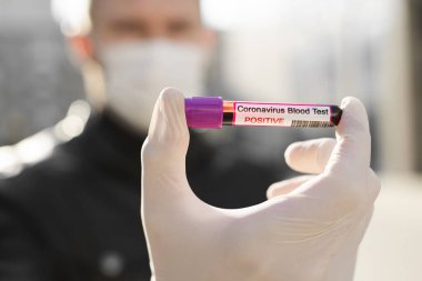 Yeni hızla yayılan Coronavirus Covid-19 araştırmaları için kan örneği taşıyan bir test tüpü tutan insanlar.