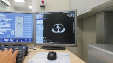KAZAN, TATARSTAN RUSSIA - 09 Ekim 2022: Çağdaş hastane ofisinde hasta omurgasının tomografi taraması. 9 Ekim 'de Kazan' da tıbbi test teknolojisi