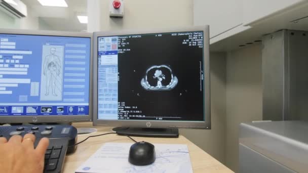Kazan Tatarstan Russia 10月09 2022 現代の病院のオフィスで コンピュータ画面上の患者の背骨のトモグラフィースキャン 10月9日にカザンで医療試験技術 — ストック動画