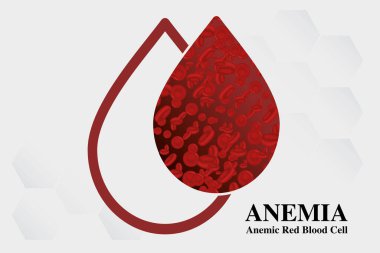 Anemi Demir kan hücresi kırmızı vektör illüstrasyon tıbbi.