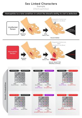 Cinsiyet Bağlantılı Karakterler Infographic Diyagram örneğinde hemofili, pıhtı pıhtılaşma faktörü hemofili erkek, kadın Punnett kare genetik olasılık gen bilim eğitim vektörü