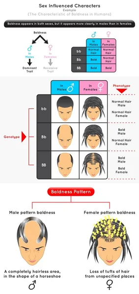 Infographic Diagram Example Characteristic Baldness Human Dominant Trait Male Recessive Стоковый вектор