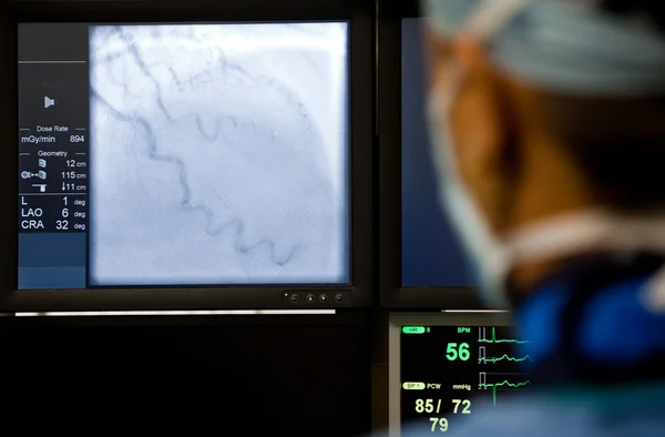 Arzt beobachtet Angiographie-Maschine — Stockfoto
