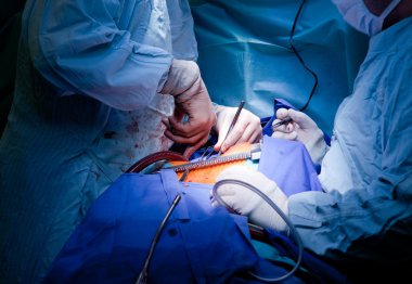 doktorlar hastanın ameliyat