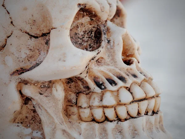 Old human skull — Stock Photo, Image
