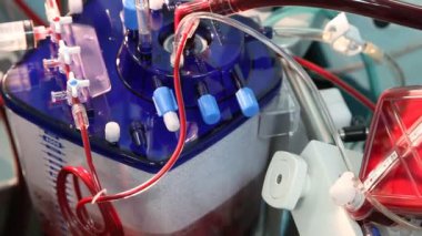 Kardiyopulmoner bypass rezervuar