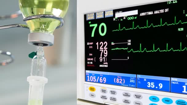 Intravenöser Tropf mit EKG-Monitor im Operationssaal — Stockvideo