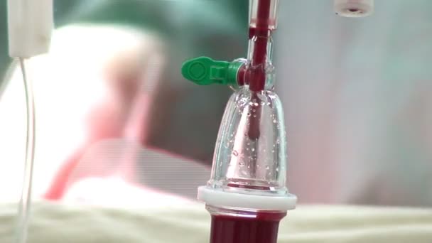 Gocciolamento di sangue endovenoso in sala operatoria — Video Stock
