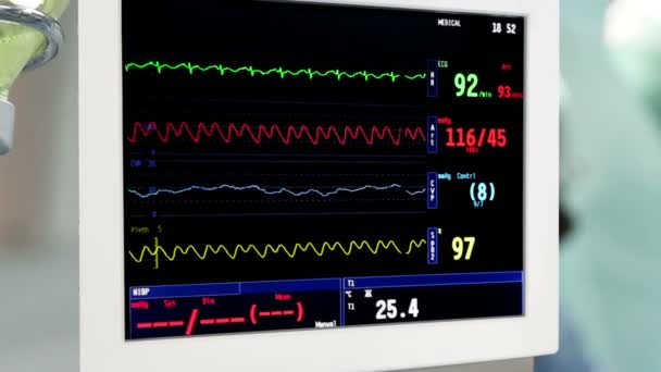 Gotejamento intravenoso com monitor na sala de operação — Vídeo de Stock