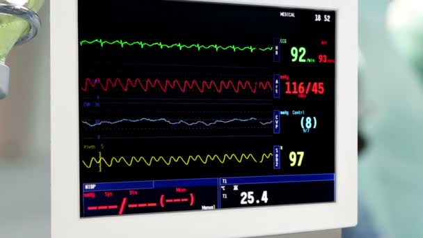 Gocciolamento endovenoso con monitor ECG in sala operatoria — Video Stock