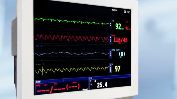 Intensivvårdsavdelning EKG monitor — Stockvideo