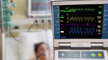 yoğun bakımda hastanın EKG monitör ve intraaortik balon counterpulsation