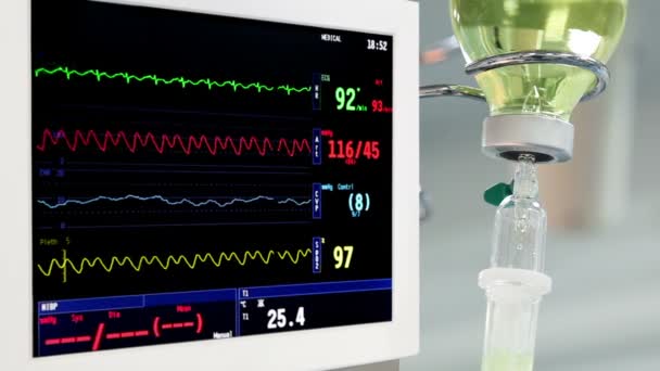 Moniteur rotatif en salle d'opération avec goutte à goutte et chirurgiens en arrière-plan — Video