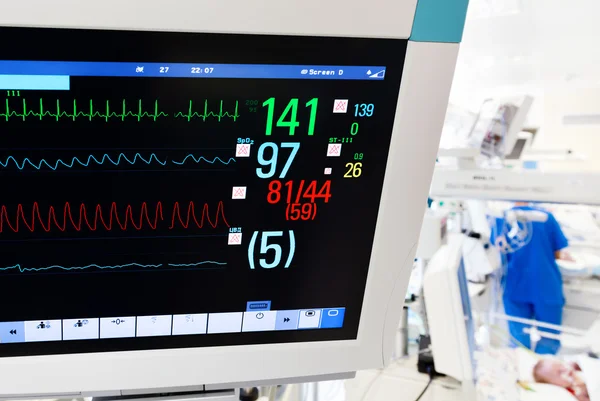 Neonatal ICU with ECG monitor — Stock Photo, Image