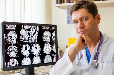 Doktor beyin bir MRI tarama ile