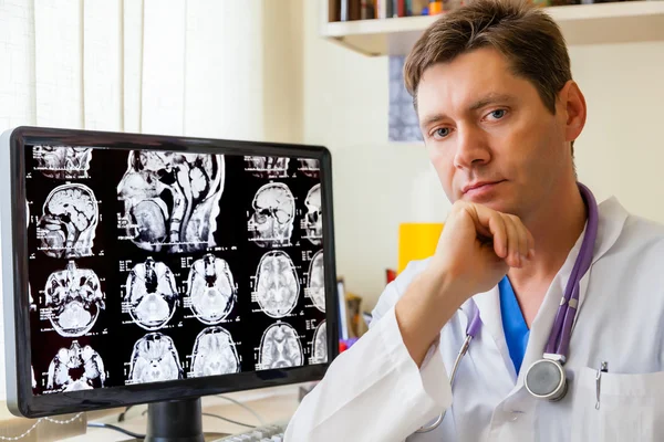 Médico con una resonancia magnética del cerebro — Foto de Stock