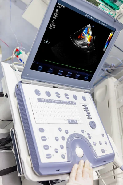 Echografie medische apparaat in icu — Stockfoto