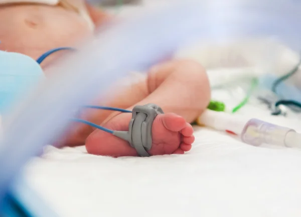 Barnets fot med pulsoximeter på intensivvårdsavdelning — Stockfoto