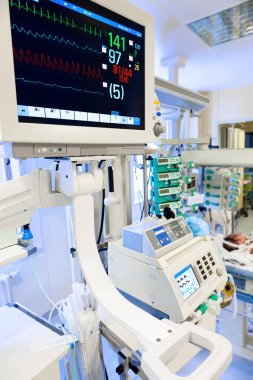 ECG monitor in neonatale icu