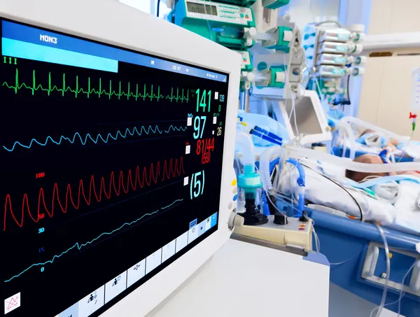 EKG monitör ile Pediatrik yoğun bakım — Stok fotoğraf