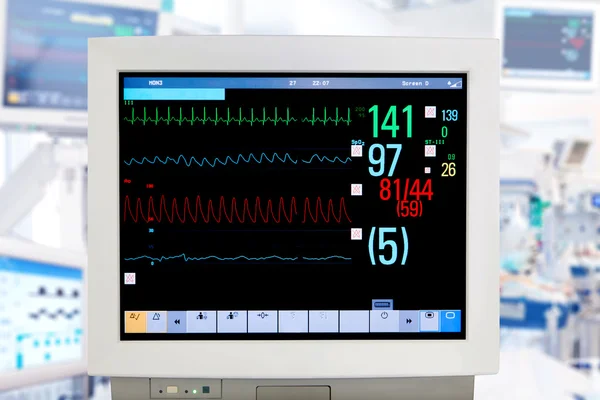 Elektrocardiogram monitor — Stockfoto