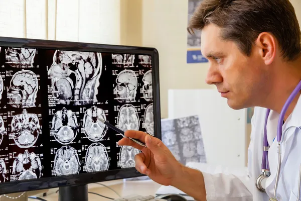 Médico examinando una resonancia magnética del cerebro — Foto de Stock