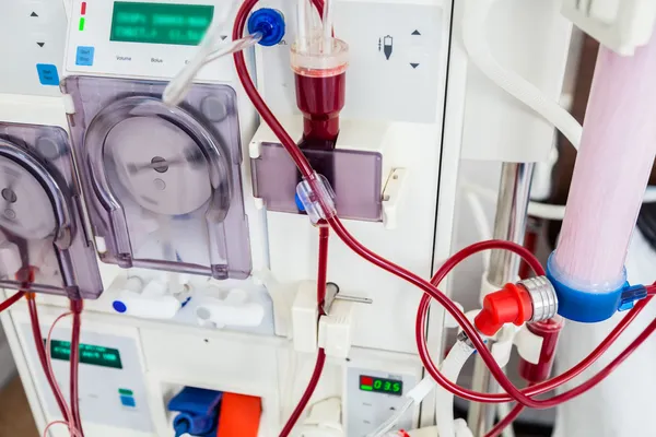 Dialysegerät mit rotierenden Pumpen. — Stockfoto