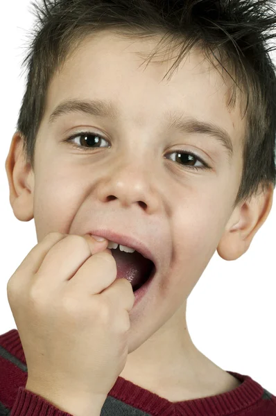 Kleine jongen toont een gebroken tand — Stockfoto