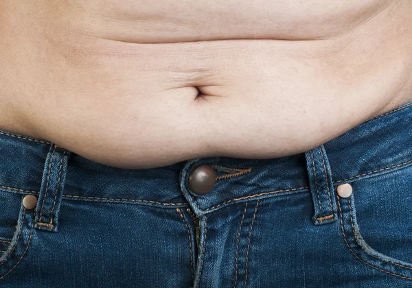 Woman pinching fat from her abdomen — Stock Photo, Image