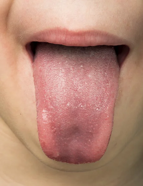 Menselijke tong uitsteekt out — Stockfoto