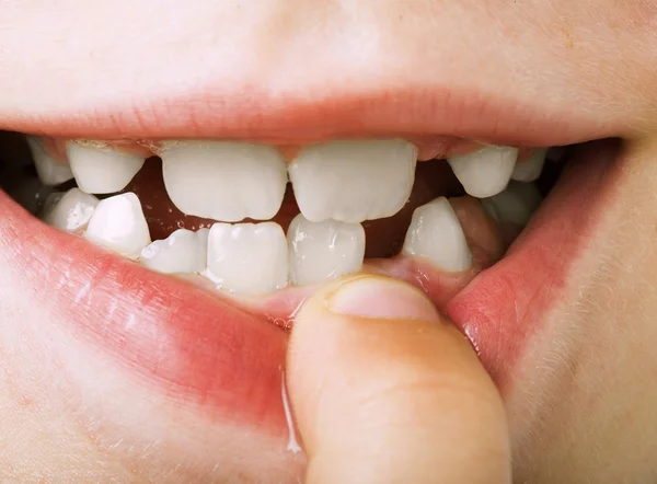 Child shows tooth — Stock Photo, Image