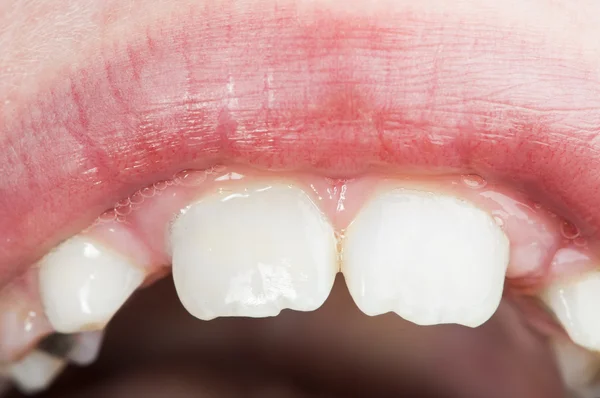 Çocuk ağız ve diş — Stok fotoğraf