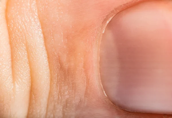 Close up human skin and claw. Macro epidermis — Stock Photo, Image