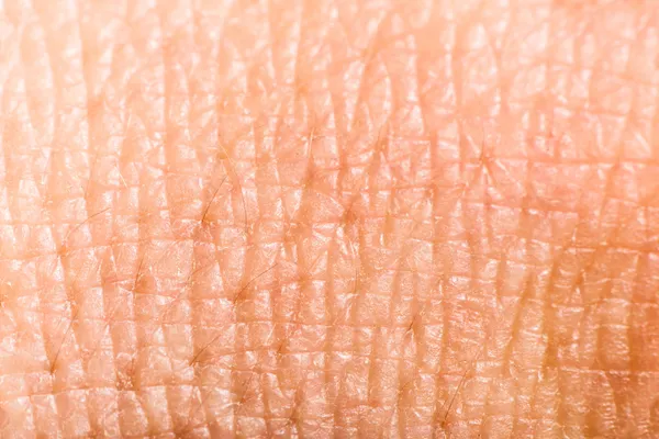 Close-up van menselijke huid. macro epidermis — Stockfoto