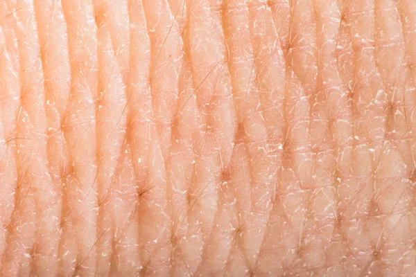 Närbild på mänsklig hud. makro epidermis — Stockfoto