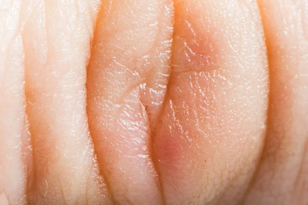 Close up human skin. Macro epidermis — Stock Photo, Image