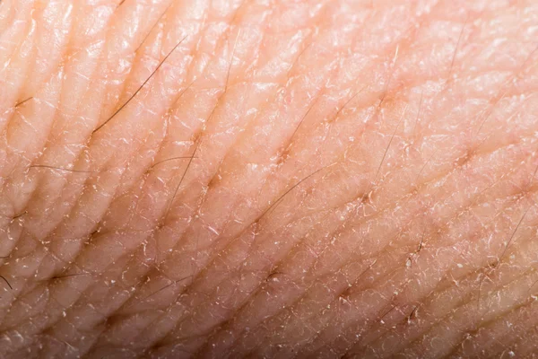 Feche a pele humana. Epiderme macro — Fotografia de Stock