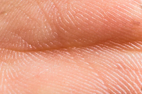 insan derisi kadar yakın. Makro epidermis