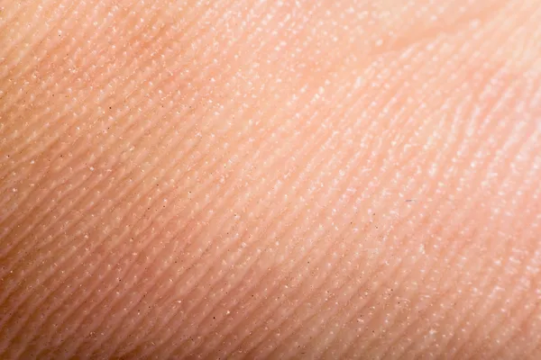 Close up human skin. Macro epidermis — Stock Photo, Image