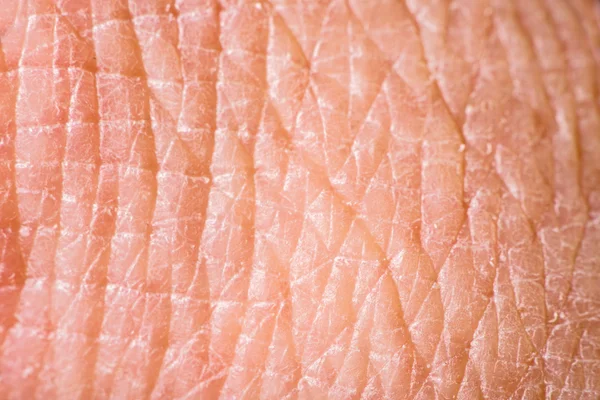 Texture of human skin — Stock Photo, Image