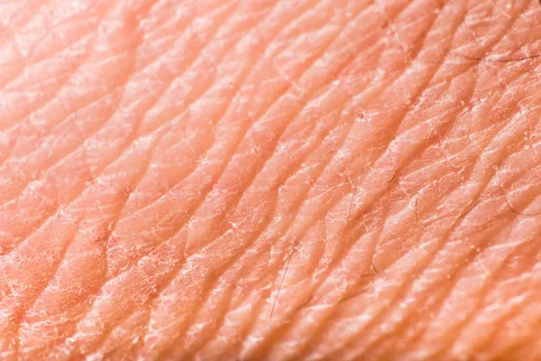 Texture of human skin — Stock Photo, Image