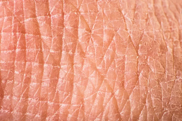 Texture of human skin — Stock Photo, Image