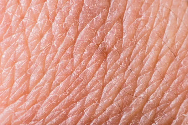 Textuur van menselijke huid — Stockfoto