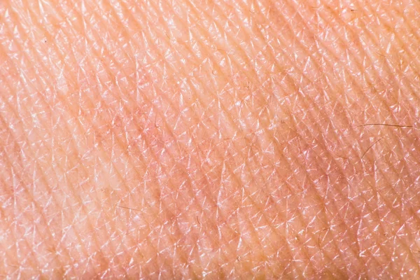 Texture of human skin — Stock Photo, Image
