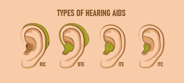 Types of hearing aids. Vector illustration clipart