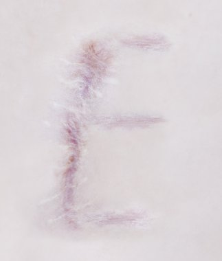 Scar letter E on human skin clipart