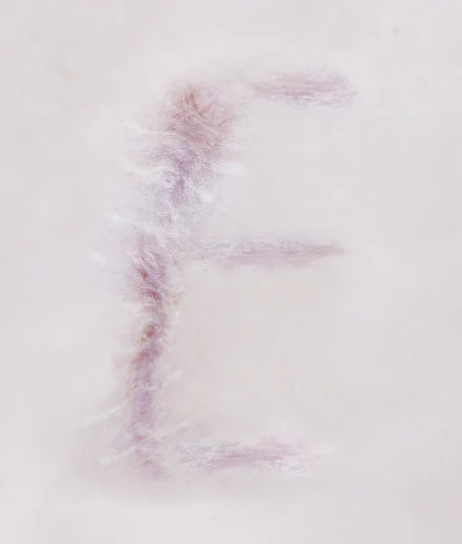 Scar letter E on human skin — Stock Photo, Image