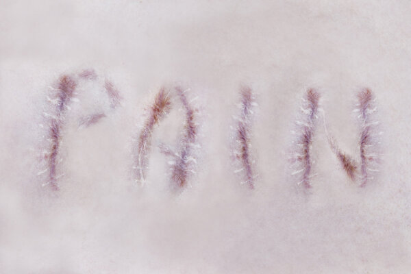 Боль и шрамы
